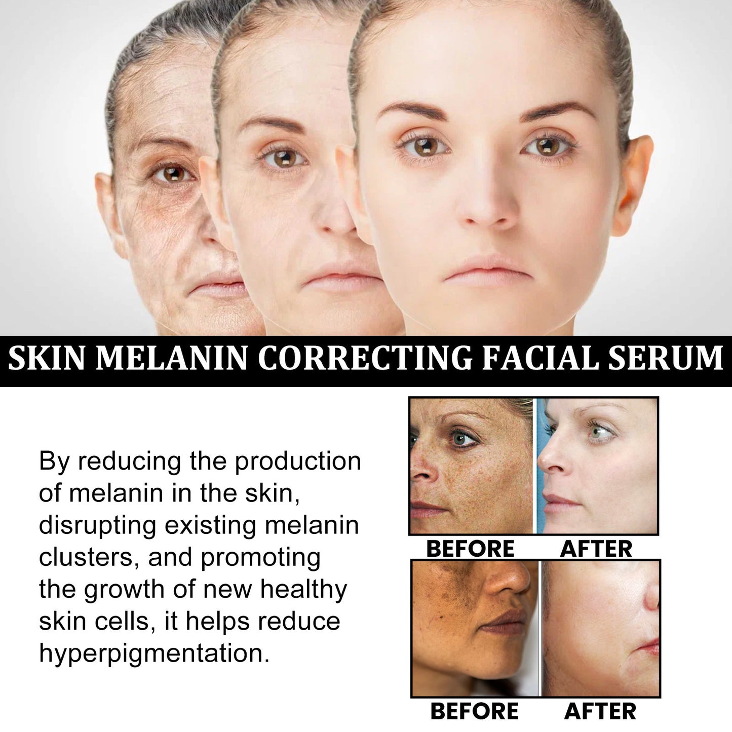 “Facial Melanin Repair Serum – Dark Spot Remover & Hydrating Essence”