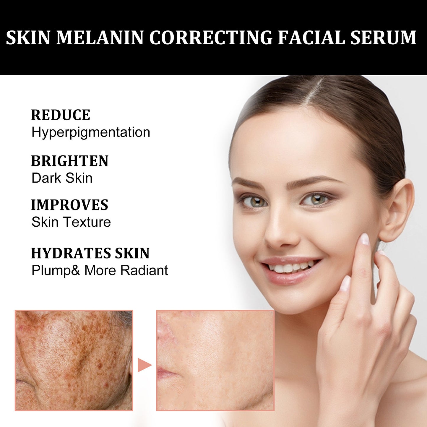 “Facial Melanin Repair Serum – Dark Spot Remover & Hydrating Essence”